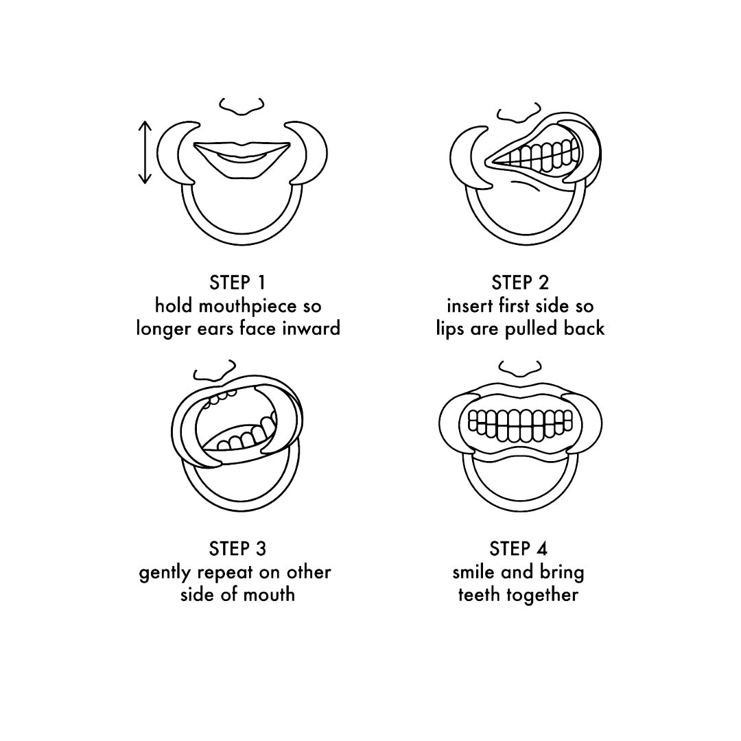 One and Done Teeth Whitening Kit